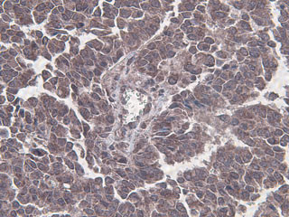 IHC-P - Beclin 1 Antibody (Ascites) AM1818a